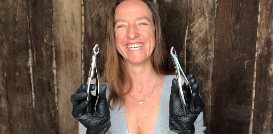 150 Forceps from Hu-Friedy - Dr. Ana Ferro | MALO CLINIC